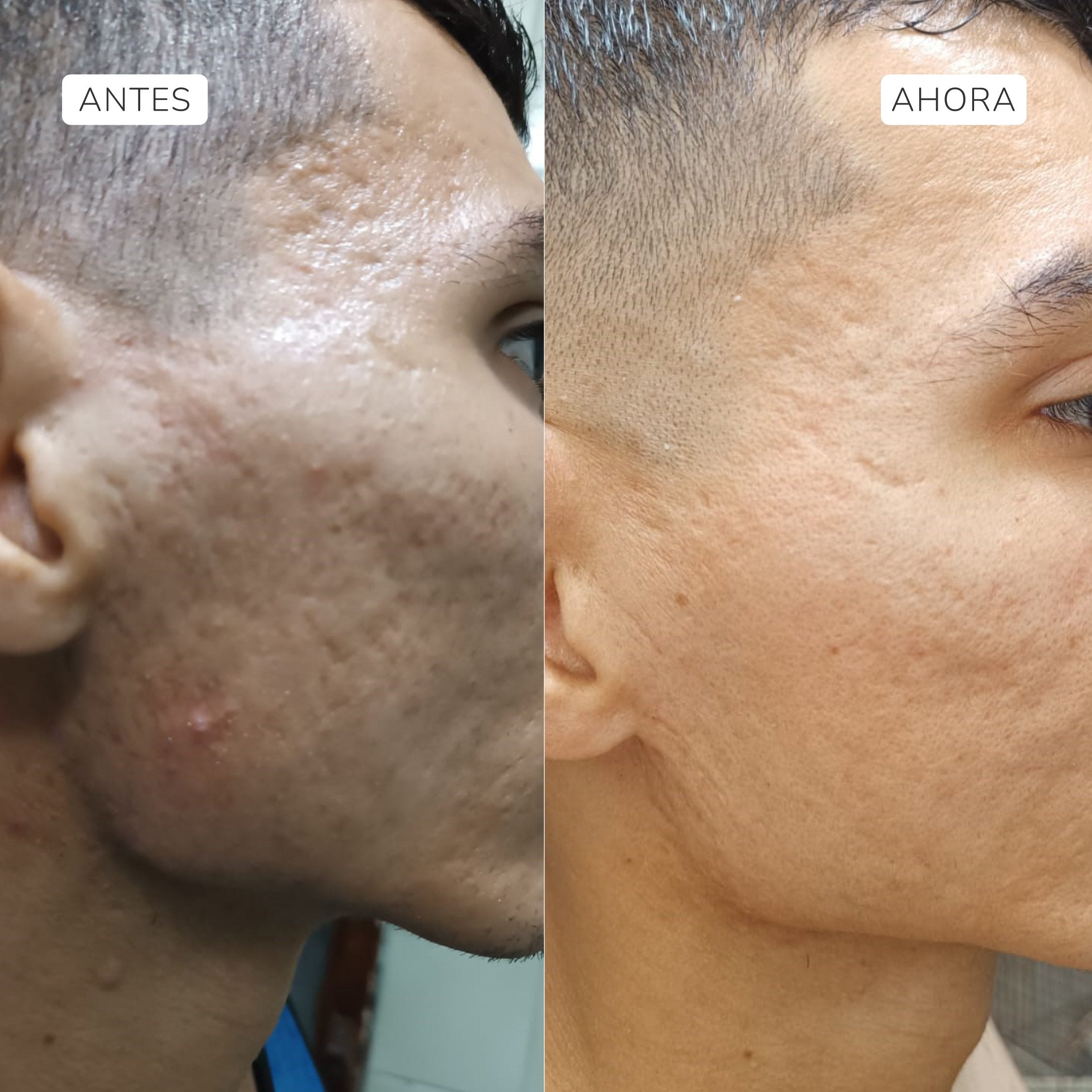 The Ordinary Glycolic Acid 7% Toning Solution | Solución Tónica