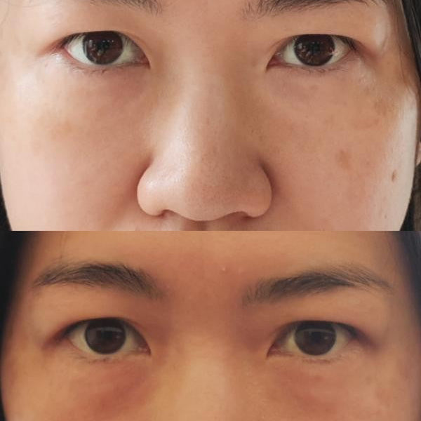 The Ordinary Multi-Peptide Eye Serum 15ml