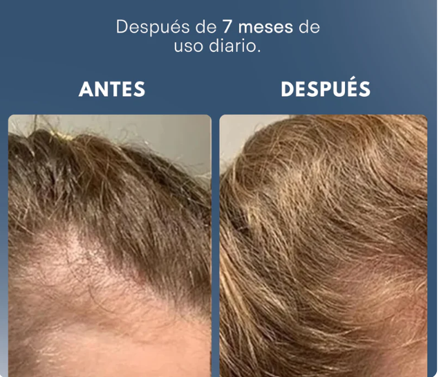 SHAMPOO EXCALVO