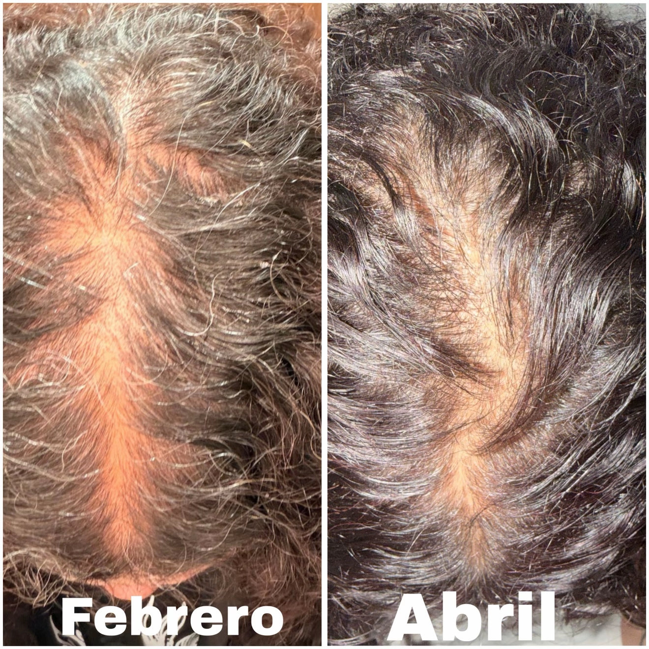 Suero Multipeptido para Densidad Capilar de The Ordinary