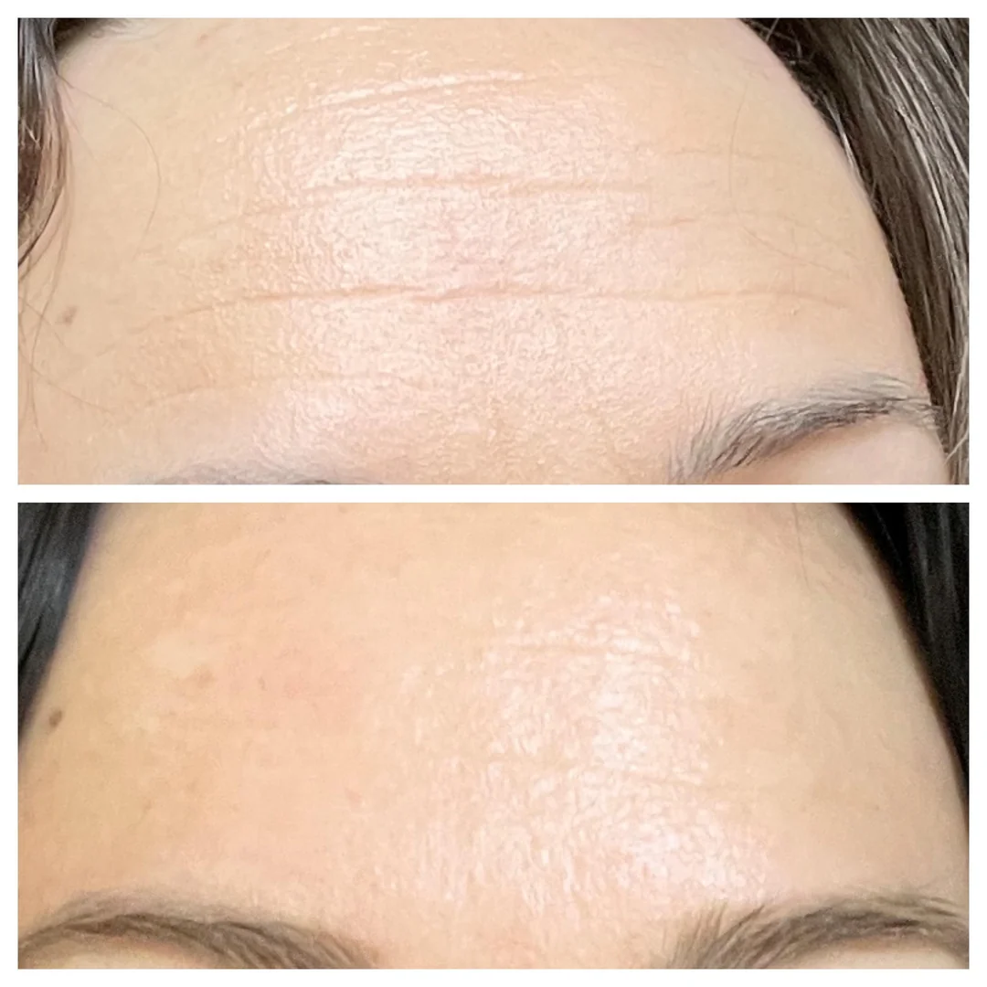 Retinal Shot Tightening Booster 15ml