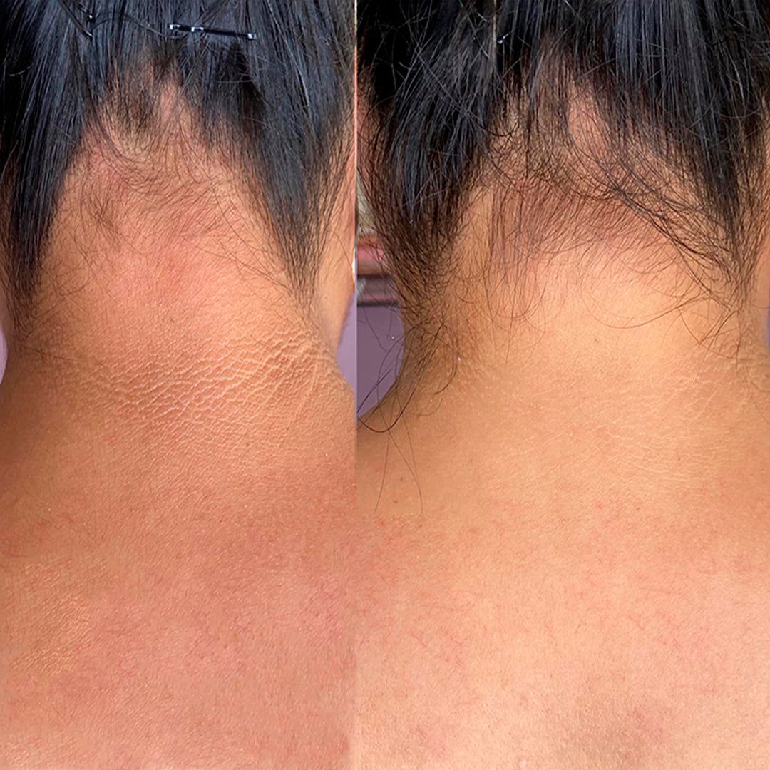 The Ordinary Ácido glicólico al 7% Tónico exfoliante para una Piel Radiante