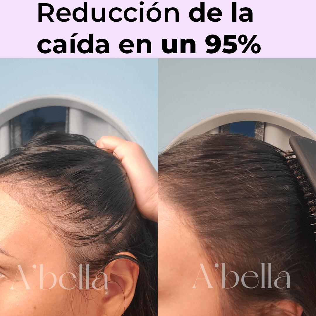 Dúo Capilar A'bella: Sérum de Crecimiento + Óleo Reparador Intensivo