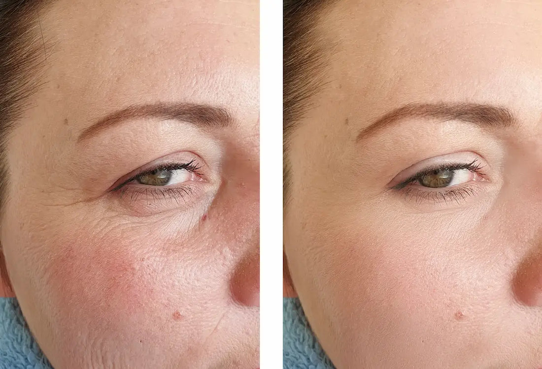Retinal Shot Tightening Booster 15ml